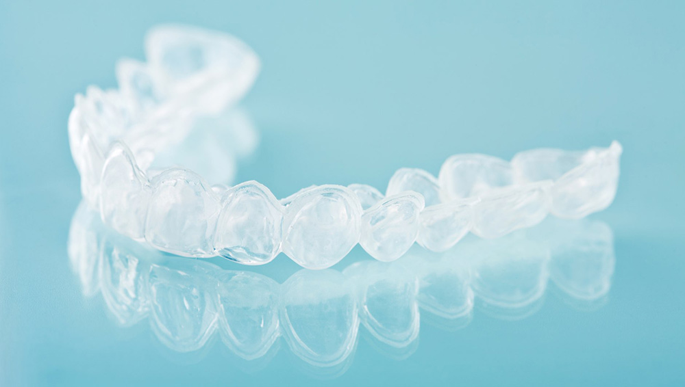 Ortodonzia invisibile | Eccellenze | Studio Dentistico Vitullo | Dentista a Chieti